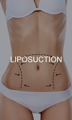liposuction